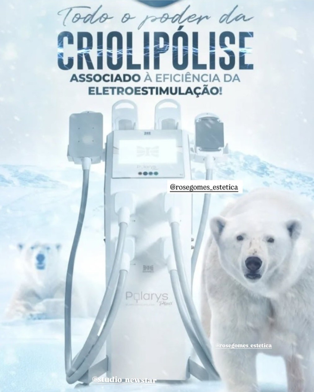 Criolipólise com eletroestimulação